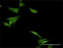 HABP4 Antibody, Novus Biologicals 0.1 mg | Buy Online | Novus Biologicals | Fisher Scientific