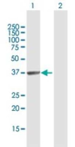 HABP4 Antibody, Novus Biologicals 0.1 mg | Buy Online | Novus Biologicals | Fisher Scientific