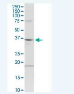 HAGHL Antibody (5B12), Novus Biologicals 100 &mu;g | Buy Online | Novus Biologicals | Fisher Scientific
