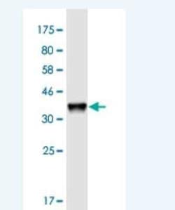 HAGHL Antibody (5B12), Novus Biologicals 100 &mu;g | Buy Online | Novus Biologicals | Fisher Scientific