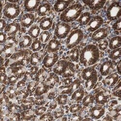 HAI-1/HGFA Inhibitor 1 Antibody, Novus Biologicals 25 &mu;L; Unconjugated:Antibodies,