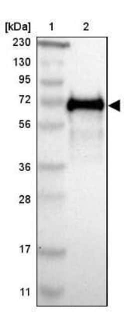 HAI-1/HGFA Inhibitor 1 Antibody, Novus Biologicals 25 &mu;L; Unconjugated:Antibodies,