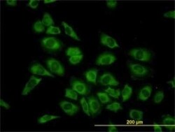 HARS Antibody (1C8), Novus Biologicals 0.1 mg | Buy Online | Novus Biologicals | Fisher Scientific