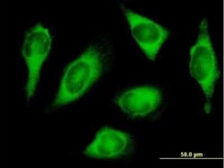 Novus Biologicals HARS Antibody, Novus Biologicals 0.05 mg | Buy Online | Novus Biologicals&trade; | Fisher Scientific