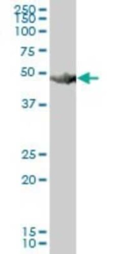 Novus Biologicals HARS Antibody, Novus Biologicals 0.05 mg | Buy Online | Novus Biologicals&trade; | Fisher Scientific