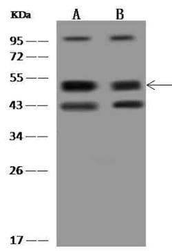HAUS8 Antibody, Novus Biologicals 50 &mu;g; Unconjugated:Antibodies, Polyclonal