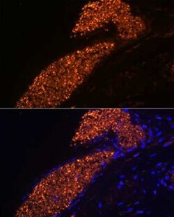 HBG1 Rabbit anti-Human, Clone: 1R9T7, Novus Biologicals 20 &mu;g; Unconjugated:Antibodies,