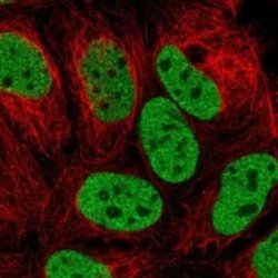 HBO1 Rabbit anti-Human, Polyclonal, Novus Biologicals 100 &mu;g; Unconjugated:Antibodies,