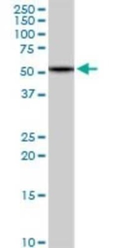 HBS1L Antibody, Novus Biologicals 0.1 mg | Buy Online | Novus Biologicals | Fisher Scientific
