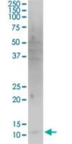 Novus Biologicals HBXIP Antibody (4G1), Novus Biologicals 0.1 mg | Buy Online | Novus Biologicals | Fisher Scientific
