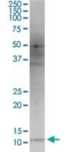 Novus Biologicals HBXIP Antibody (4G1), Novus Biologicals 0.1 mg | Buy Online | Novus Biologicals | Fisher Scientific