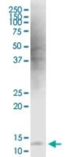 Novus Biologicals HBXIP Antibody (4G1), Novus Biologicals 0.1 mg | Buy Online | Novus Biologicals | Fisher Scientific