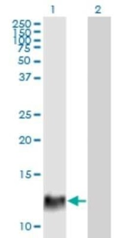 Novus Biologicals HBXIP Antibody (4G1), Novus Biologicals 0.1 mg | Buy Online | Novus Biologicals | Fisher Scientific
