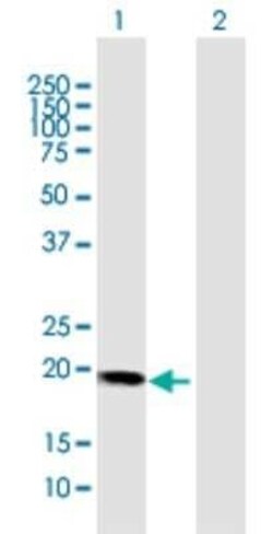 HBXIP Antibody, Novus Biologicals 0.1 mg | Buy Online | Novus Biologicals | Fisher Scientific