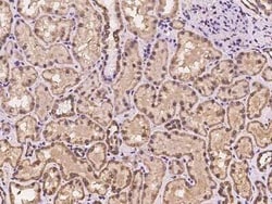 HCA59 Antibody, Novus Biologicals:Antibodies:Primary Antibodies