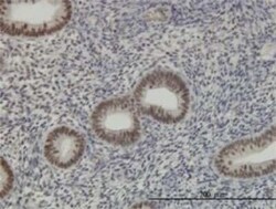 HCC1 Antibody (4G8), Novus Biologicals 0.1 mg | Buy Online | Novus Biologicals | Fisher Scientific