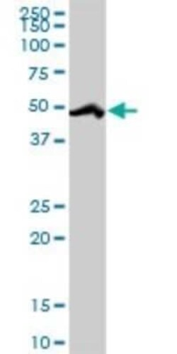 HCC1 Antibody, Novus Biologicals 0.1 mg | Buy Online | Novus Biologicals | Fisher Scientific
