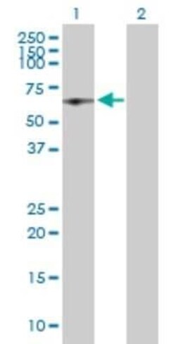 HCC1 Antibody, Novus Biologicals 0.1 mg | Buy Online | Novus Biologicals | Fisher Scientific