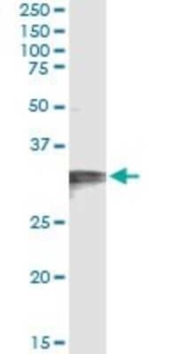 HCCS Antibody (3C7), Novus Biologicals 0.1 mg | Buy Online | Novus Biologicals | Fisher Scientific