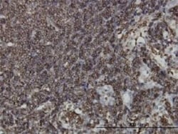 HCLS1 Antibody (2A6), Novus Biologicals 0.1 mg | Buy Online | Novus Biologicals | Fisher Scientific