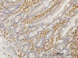 Novus Biologicals HCLS1 Antibody (2A9), Novus Biologicals 0.1 mg | Buy Online | Novus Biologicals&trade; | Fisher Scientific