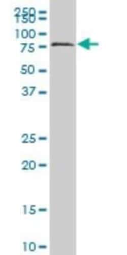 Novus Biologicals HCLS1 Antibody (2A9), Novus Biologicals 0.1 mg | Buy Online | Novus Biologicals&trade; | Fisher Scientific