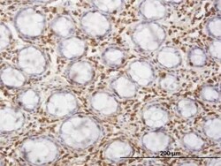 HCLS1 Antibody (3F4), Novus Biologicals 0.1 mg | Buy Online | Novus Biologicals | Fisher Scientific