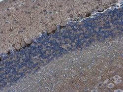 HCN1 Antibody, Novus Biologicals 100 &mu;g | Buy Online | Novus Biologicals | Fisher Scientific