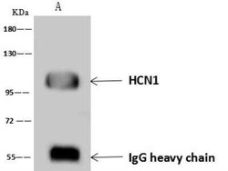 HCN1 Antibody, Novus Biologicals 50 &mu;g; Unconjugated:Anticuerpos