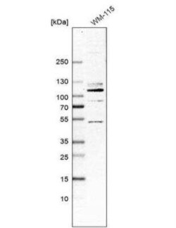HCN1 Antibody, Novus Biologicals 0.1 mL; Unconjugated:Antibodies, Polyclonal