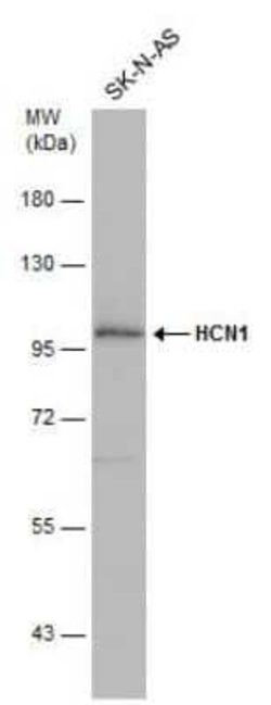 HCN1 Antibody, Novus Biologicals 100 &mu;g | Buy Online | Novus Biologicals | Fisher Scientific
