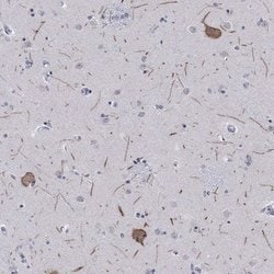 HCN4 Rabbit anti-Human, Polyclonal, Novus Biologicals 25 &mu;g; Unconjugated:Antibodies,