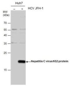 HCV-NS2 Antibody, Novus Biologicals 100 &mu;g; Unconjugated:Antibodies,