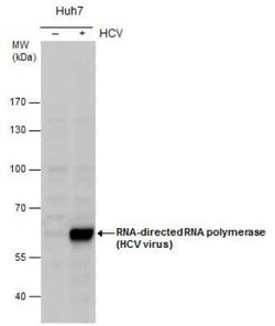 HCV-NS5b Antibody, Novus Biologicals 100 &mu;g | Buy Online | Novus Biologicals | Fisher Scientific