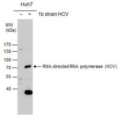 HCV-NS5b Antibody, Novus Biologicals 100 &mu;g | Buy Online | Novus Biologicals | Fisher Scientific