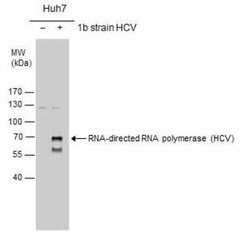 HCV-NS5b Antibody, Novus Biologicals 100 &mu;g | Buy Online | Novus Biologicals | Fisher Scientific