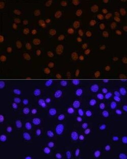 HDAC1 Rabbit anti-Human, Mouse, Rat, Clone: 2L6O7, Novus Biologicals 20 &mu;g | Buy Online | Novus Biologicals | Fisher Scientific