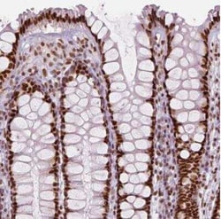 HDAC1 Antibody (CL0510), Novus Biologicals 25 &mu;L, Unconjugated:Antibodies,