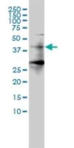 HDAC11 Antibody (1C2-2G5), Novus Biologicals 0.1 mg | Buy Online | Novus Biologicals | Fisher Scientific