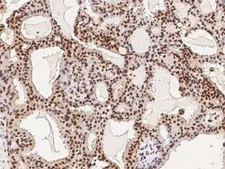 HDAC11 Antibody, Novus Biologicals 100 &mu;g | Buy Online | Novus Biologicals | Fisher Scientific