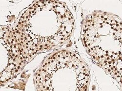 HDAC11 Antibody, Novus Biologicals 100 &mu;g | Buy Online | Novus Biologicals | Fisher Scientific