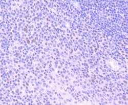 HDAC3 Rabbit anti-Human, Clone: SC55-02, Novus Biologicals 100 &mu;L | Buy Online | Novus Biologicals | Fisher Scientific