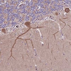 HDAC5 Antibody, Novus Biologicals 25 &mu;L | Buy Online | Novus Biologicals | Fisher Scientific