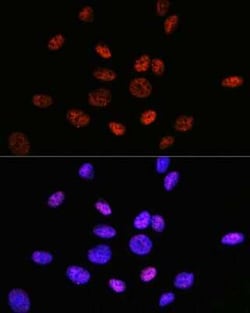 HDAC9 Rabbit anti-Human, Rat, Clone: 3L5E5, Novus Biologicals:Antibodies:Primary