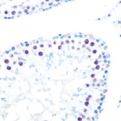 HDAC9 Rabbit anti-Human, Rat, Clone: 3L5E5, Novus Biologicals:Antibodies:Primary