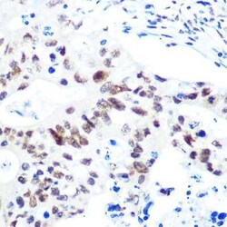 HDAC9 Rabbit anti-Human, Rat, Clone: 3L5E5, Novus Biologicals:Antibodies:Primary