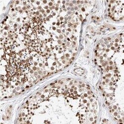 HDAC9 Antibody, Novus Biologicals:Antibodies:Primary Antibodies