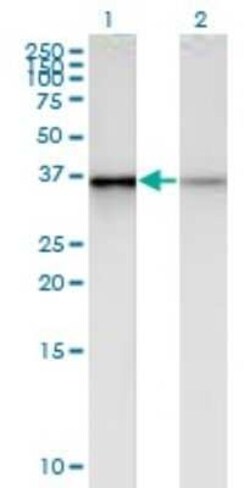 HDC2/PHC2 Antibody (1F4), Novus Biologicals 0.1 mg | Buy Online | Novus Biologicals | Fisher Scientific