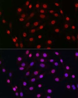 HDGF Rabbit anti-Human, Mouse, Rat, Clone: 5U7A7, Novus Biologicals 100 &mu;g | Buy Online | Novus Biologicals | Fisher Scientific