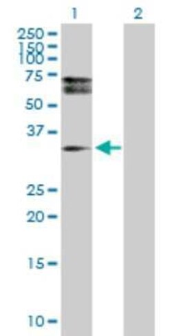HDGFRP3 Antibody, Novus Biologicals 0.1 mg | Buy Online | Novus Biologicals | Fisher Scientific
